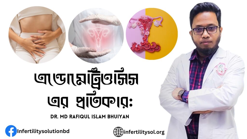 এন্ডোমেট্রিওসিস এর প্রতিকার